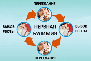 Лечение булимии в Славгороде